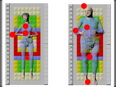 Matratzenzonen:links: Frau, 50 J., 5. Perzentil, normal, NN, Rückenlage, Becken mittig
rechts: Mann, 50 J., 95.Perzentil, endomorph, SRN, Rückenlage, Becken mittig